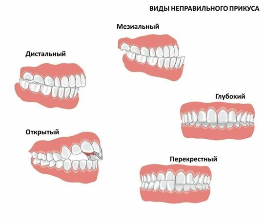 Ортодонтия
