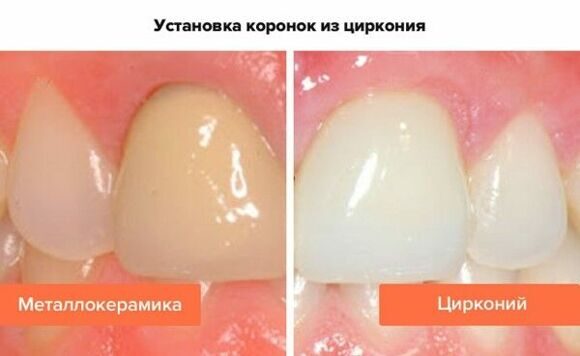 Рисунок1